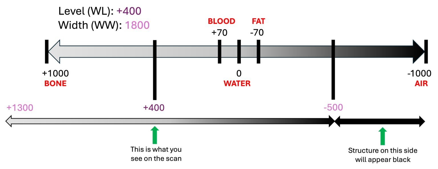 The Hounsfield Unit, Window Level & Width – 3 AM SCAN