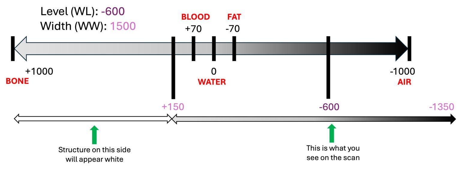 Window Unit Level The Hounsfield Unit, Window Level & Width – 3 AM SCAN