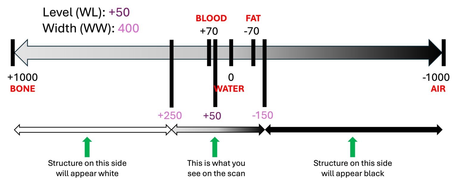 Window Level Ad Window Width The Hounsfield Unit, Window Level & Width – 3 AM SCAN